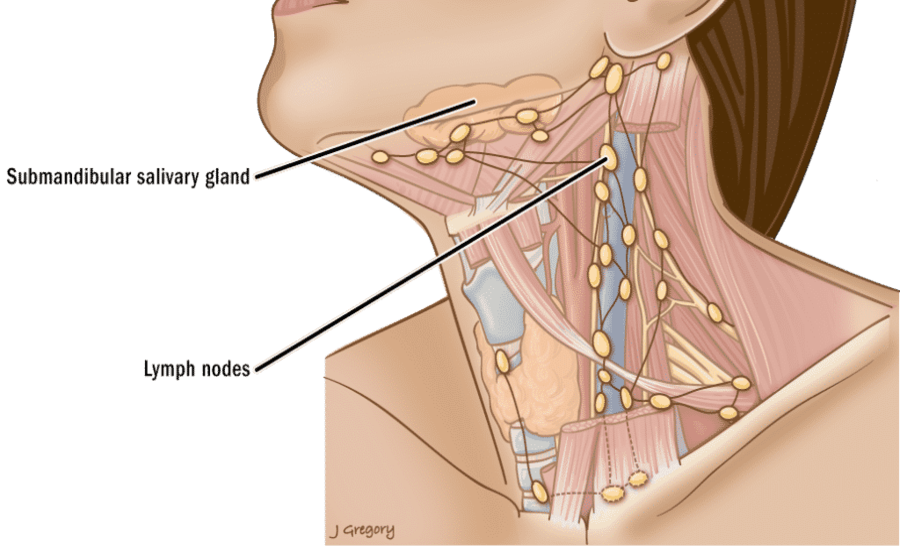 73-neck-lymph_nodes-1024x542-3.png